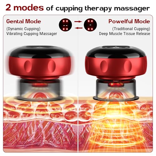Smart Cupping Massager, 7-in-1 Cupping Set with Red Light and 2 Modes for Muscle Relaxation (1 Pack)